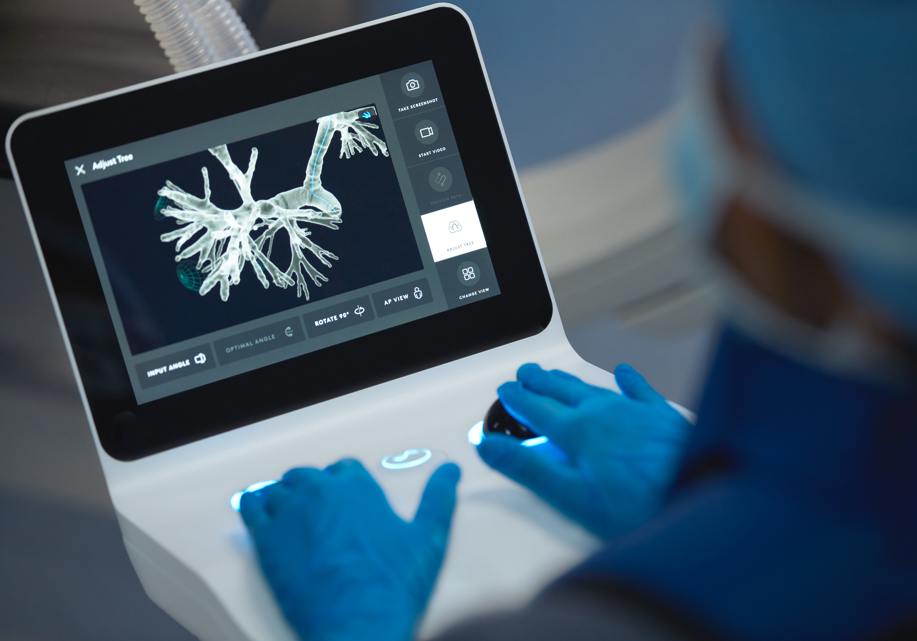 Image of Ion Endoluminal System for minimally invasive lung biopsies in South Florida